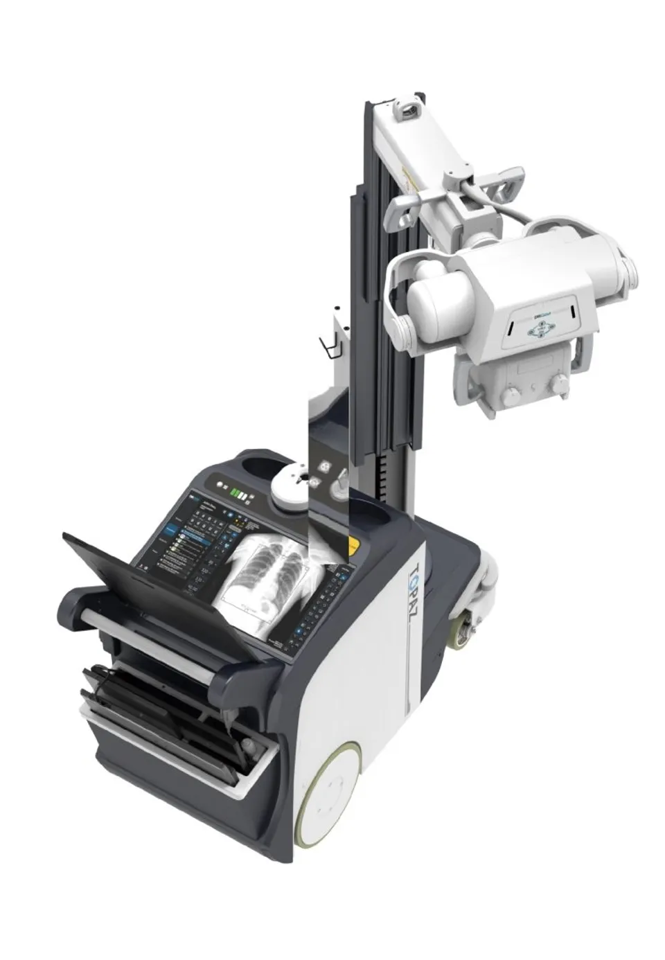 Digital Mobile X-Ray Systems